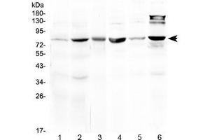 Western blot testing of 1) rat liver, 2) mouse liver, 3) mouse heart, 4) mouse testis, 5) human MCF7 and 6) human HeLa lysate at 0. (HSD17B4 anticorps)