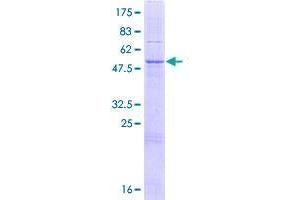 Image no. 1 for CTD Nuclear Envelope Phosphatase 1a (CTDNEP1A) (AA 1-244) protein (GST tag) (ABIN1352079)