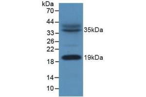 Figure. (NDUFAB1 anticorps  (AA 5-129))