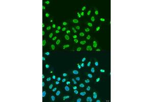 Immunofluorescence analysis of U2OS cells using CBX5 antibody.