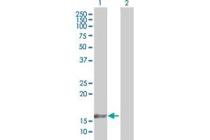 Western Blot analysis of TAF12 expression in transfected 293T cell line by TAF12 MaxPab polyclonal antibody.