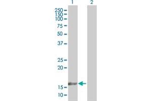 Western Blot analysis of TAF12 expression in transfected 293T cell line by TAF12 MaxPab polyclonal antibody. (TAF12 anticorps  (AA 1-161))