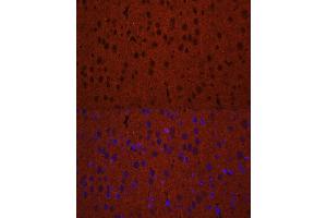 Immunofluorescence analysis of mouse brain using STXBP1 antibody (ABIN6128255, ABIN6148673, ABIN6148674 and ABIN6221073) at dilution of 1:50.