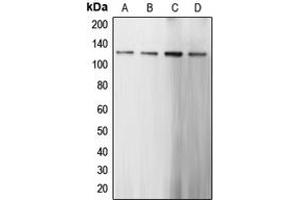 Western blot analysis of CARD6 expression in HeLa (A), Jurkat (B), mouse kidney (C), rat brain (D) whole cell lysates.