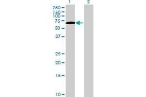 Western Blot analysis of SPINT1 expression in transfected 293T cell line by SPINT1 MaxPab polyclonal antibody.