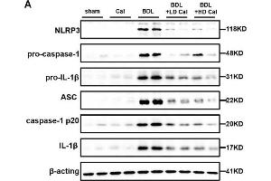 Calcipotriol supplement inhibits the NLRP3 inflammasome activation during DDC-induced and BDL-induced cholestatic liver injury. (NLRP3 anticorps  (C-Term))