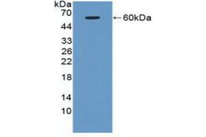 Detection of Recombinant ATM, Human using Polyclonal Antibody to Ataxia Telangiectasia Mutated (ATM) (ATM anticorps  (AA 2484-2748))