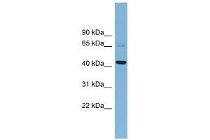 UEVLD antibody used at 1 ug/ml to detect target protein. (UEVLD anticorps  (Middle Region))