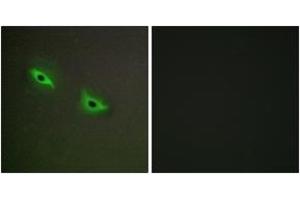 Immunofluorescence (IF) image for anti-Cytochrome P450, Family 2, Subfamily S, Polypeptide 1 (CYP2S1) (AA 181-230) antibody (ABIN2889949) (CYP2S1 anticorps  (AA 181-230))