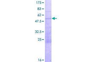 Image no. 1 for Coiled-Coil Domain Containing 88B (CCDC88B) (AA 1-223) protein (GST tag) (ABIN1348339)