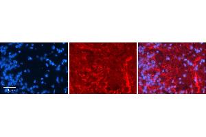 Rabbit Anti-GRIK5 Antibody     Formalin Fixed Paraffin Embedded Tissue: Human Pineal Tissue  Observed Staining: Membrane in cell processes  Primary Antibody Concentration: 1:100  Other Working Concentrations: 1/600  Secondary Antibody: Donkey anti-Rabbit-Cy3  Secondary Antibody Concentration: 1:200  Magnification: 20X  Exposure Time: 0. (GRIK5 anticorps  (Middle Region))