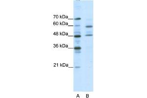 Human Jurkat; WB Suggested Anti-TFCP2L1 Antibody Titration: 0. (TFCP2L1 anticorps  (Middle Region))