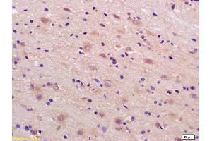 Formalin-fixed and paraffin embedded rat brain labeled with Rabbit Anti phospho-LRP1(Ser4523) Polyclonal Antibody, Unconjugated (ABIN801648) at 1:200 followed by conjugation to the secondary antibody and DAB staining (LRP1 anticorps  (pSer4523))