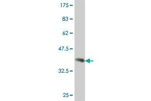 Western Blot detection against Immunogen (37. (SNAP91 anticorps  (AA 156-255))