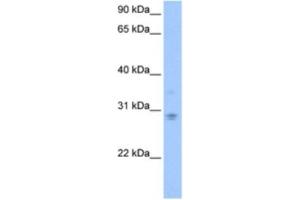 Western Blotting (WB) image for anti-DCN1, Defective in Cullin Neddylation 1, Domain Containing 3 (DCUN1D3) antibody (ABIN2463546)