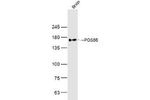 Mouse brain lysates probed with PDS5B Polyclonal Antibody, Unconjugated  at 1:300 dilution and 4˚C overnight incubation.