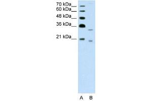 DNASE2B antibody used at 1.