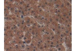 Detection of COL1a1 in Human Liver Tissue using Polyclonal Antibody to Collagen Type I Alpha 1 (COL1a1)