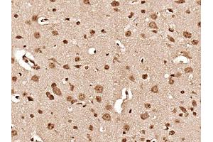 Paraformaldehyde-fixed, paraffin embedded mouse brain, Antigen retrieval by boiling in sodium citrate buffer (pH6) for 15min, Block endogenous peroxidase by 3% hydrogen peroxide for 30 minutes, Blocking buffer (normal goat serum) at 37°C for 20min, Antibody incubation with Hsc70 Polyclonal Antibody at 1:400 overnight at 4°C, followed by a conjugated secondary and DAB staining.