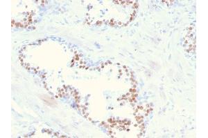 Formalin-fixed, paraffin-embedded human prostate stained with NKX3.