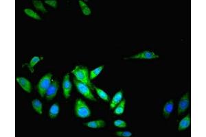 Immunofluorescent analysis of Hela cells using ABIN7158066 at dilution of 1:100 and Alexa Fluor 488-congugated AffiniPure Goat Anti-Rabbit IgG(H+L) (LRRFIP1 anticorps  (AA 1-315))