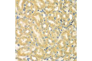 Immunohistochemistry of paraffin-embedded mouse kidney using MOCS3 antibody at dilution of 1:100 (x400 lens). (MOCS3 anticorps)