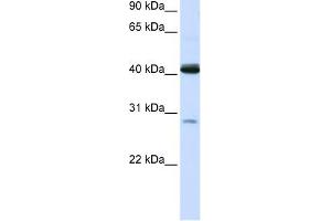 GCDH antibody used at 1 ug/ml to detect target protein. (GCDH anticorps  (N-Term))