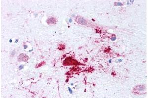 Human Brain, Alzheimers (formalin-fixed, paraffin-embedded) stained with BACE1 antibody ABIN213580 at 2. (BACE1 anticorps  (N-Term))