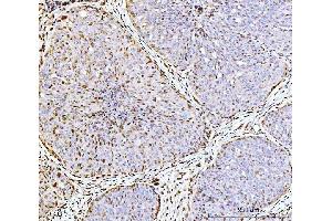 IHC analysis of ARL6IP6 using anti-ARL6IP6 antibody (ABIN7603020).