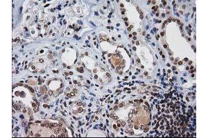 Image no. 11 for anti-Nonhomologous End-Joining Factor 1 (NHEJ1) antibody (ABIN1499728)