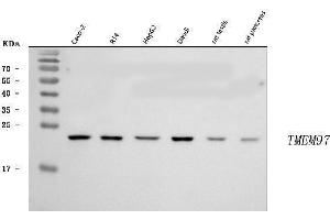 Western blot analysis of TMEM97 using anti-TMEM97 antibody (ABIN7601869).