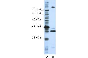WB Suggested Anti-FUSIP1 Antibody Titration:  0.