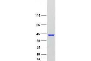 Validation with Western Blot