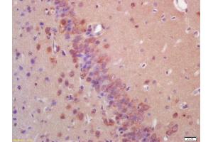 Formalin-fixed and paraffin embedded rat brain labeled with Anti-EIF2AK2/PKR Polyclonal Antibody, Unconjugated (ABIN687307) at 1:200 followed by conjugation to the secondary antibody and DAB staining (E2AK2/PKR anticorps  (AA 251-360))
