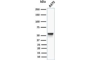 Western Blot Analysis of human A375 cell lysate using Vimentin Mouse Monoclonal Antibody (VM452).