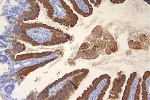 IHC analysis of Krt20 using anti-Krt20 antibody (ABIN7601133). (KRT20 anticorps  (AA 29-431))