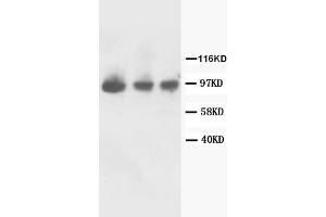 Lane 1: Rat Kidney Tissue Lysate. (FGFR2 anticorps  (C-Term))