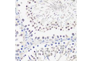 Immunohistochemistry of paraffin-embedded rat testis using PBK antibody (ABIN1682870, ABIN3019240, ABIN3019241 and ABIN6220784) at dilution of 1:100 (40x lens). (PBK anticorps  (AA 1-322))