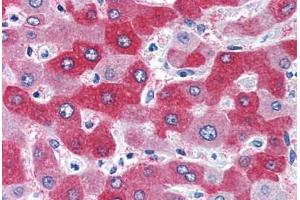 Human Liver (formalin-fixed, paraffin-embedded) stained with FTCD antibody ABIN351477 at 3. (FTCD anticorps  (AA 203-216))
