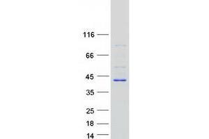 Biliverdin Reductase A (BLVRA) protein (Myc-DYKDDDDK Tag)