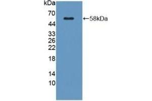 Detection of Recombinant KLK1, Mouse using Polyclonal Antibody to Kallikrein 1 (KLK1)