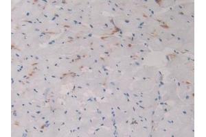 Detection of CBG in Rat Heart Tissue using Polyclonal Antibody to Corticosteroid Binding Globulin (CBG)