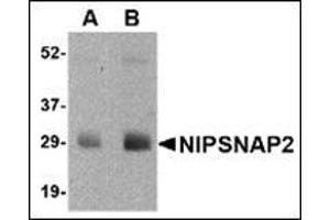 Western blot analysis of NIPSNAP2 in human skeletal muscle tissue lysate with this product at (A) 0.