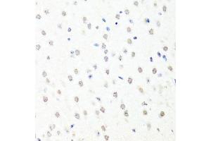 Immunohistochemistry of paraffin-embedded mouse brain using CHRAC1 antibody. (CHRAC1 anticorps  (AA 1-131))