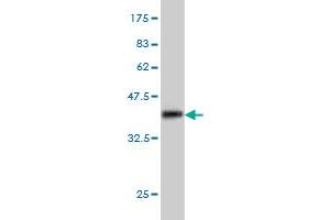 Western Blot detection against Immunogen (36. (MAP3K4 anticorps  (AA 1201-1300))