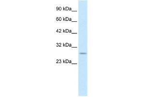 WB Suggested Anti-RNF141 Antibody Titration:  0. (RNF141 anticorps  (Middle Region))