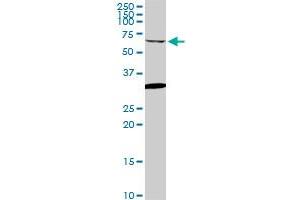 GRK6 monoclonal antibody (M06), clone 2G1.