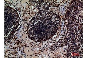 Immunohistochemistry (IHC) analysis of paraffin-embedded Human Lymph, antibody was diluted at 1:100.