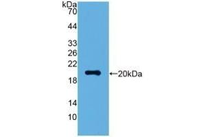 Detection of Recombinant VSNL1, Human using Polyclonal Antibody to Visinin Like Protein 1 (VSNL1) (VSNL1 anticorps  (AA 39-184))