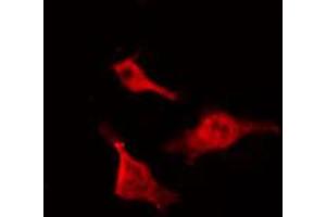 ABIN6267467 staining NIH-3T3 by IF/ICC. (CDC25B anticorps  (pSer323))